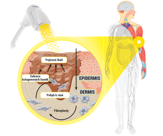 BIOPTRON_FlipChart_page14_cz.png